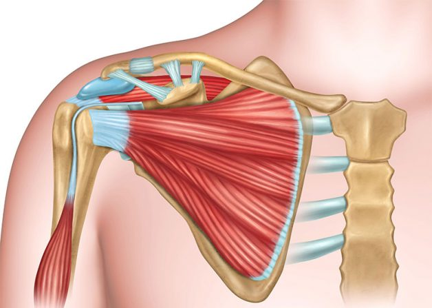 Liệu có thực sự cần thiết phải mổ vai hay không?